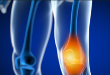 무릎 통증이 생기는 원인과 예방법