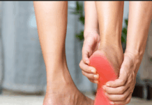 족적근막염의 원인과 증상 및 치료법