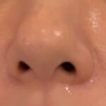 여름철 모공 관리법